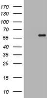 Monoclonal Mouse anti-Human ETS2 Antibody (clone OTI3E10, WB)