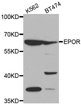 Polyclonal Rabbit anti-Human EPOR / EPO Receptor Antibody (IHC, WB)
