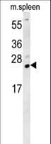 TMUB1 Antibody (aa112-141)