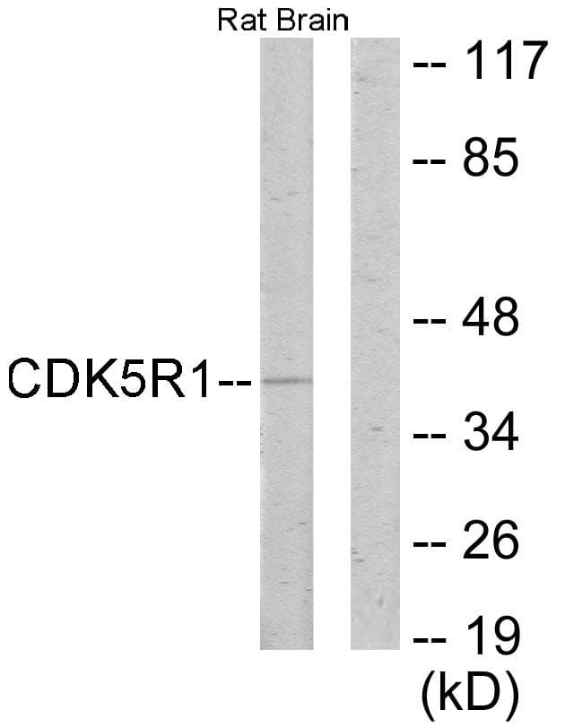 Polyclonal Rabbit anti-Human CDK5R1 Antibody (IF, WB)