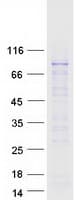 Human RNF168 Protein (Recombinant Myc-DDK (Flag))
