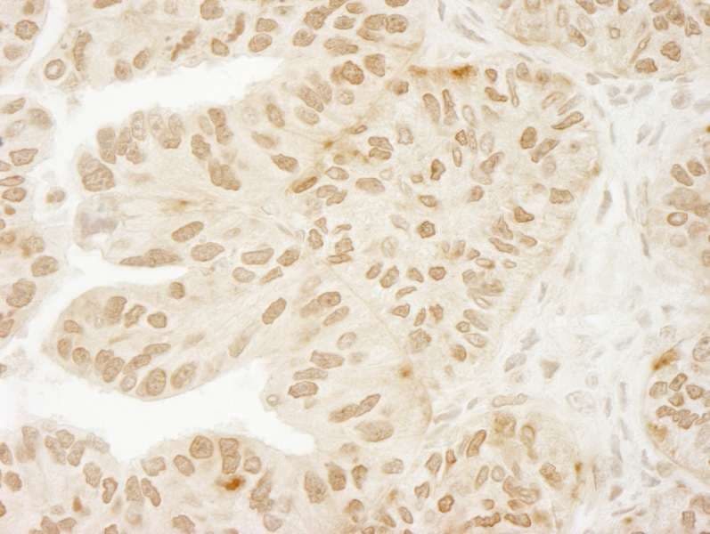 USP15 Antibody (aa960-C-term)