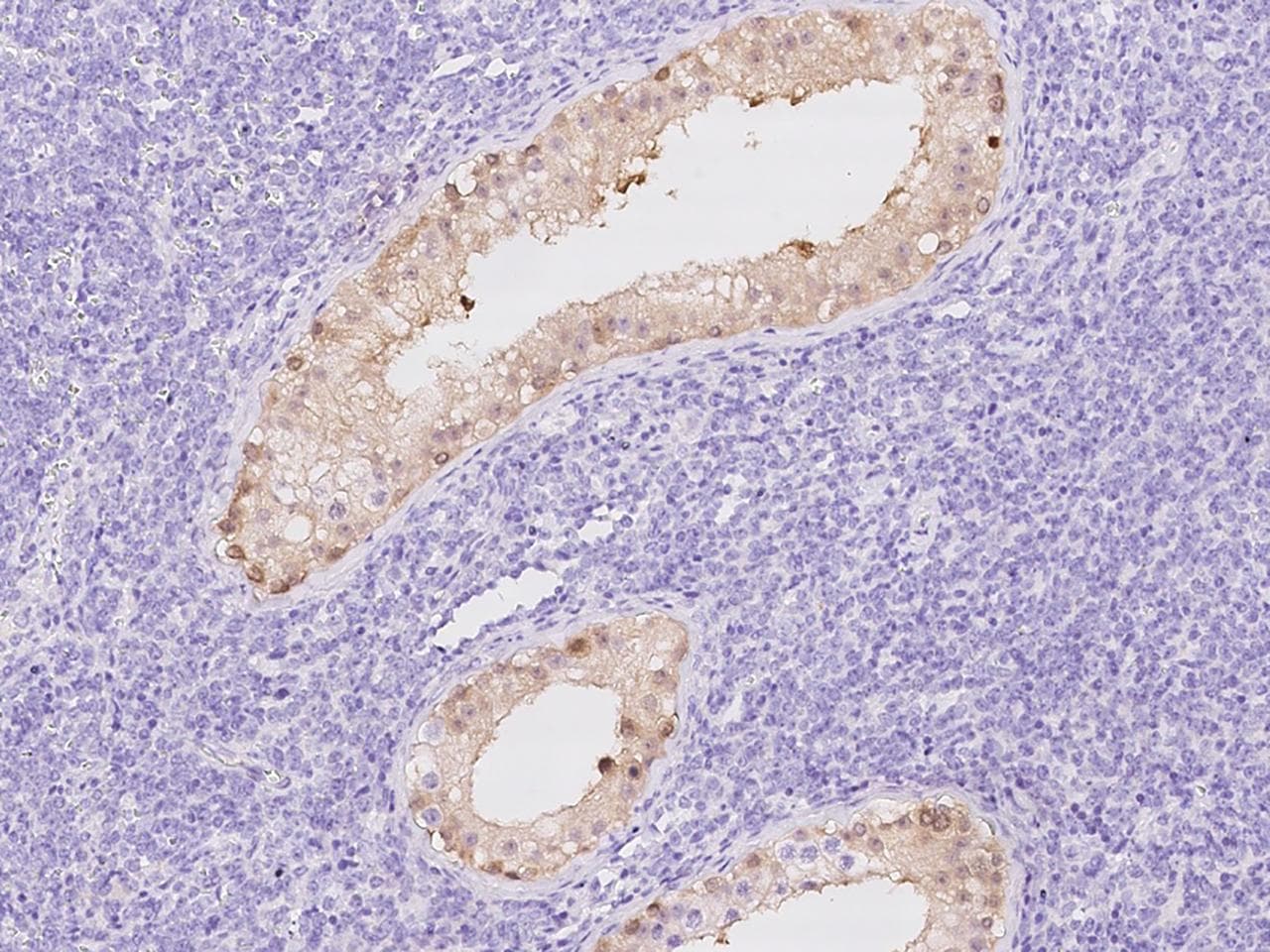 CYB5R2 Antibody