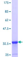 Human S100P Protein (Recombinant GST, N-terminus)