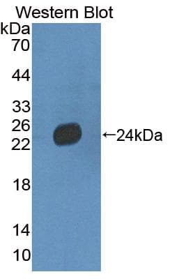 LAMB3 / Laminin Beta 3 Antibody (aa595-778)
