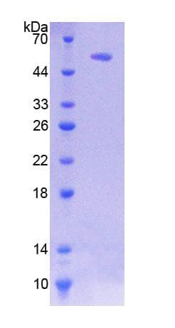 Human HSF2 Protein (Recombinant His-GST)