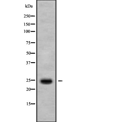 Polyclonal Rabbit anti-Human IL37 Antibody (WB)