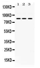 CCM1 / KRIT1 Antibody