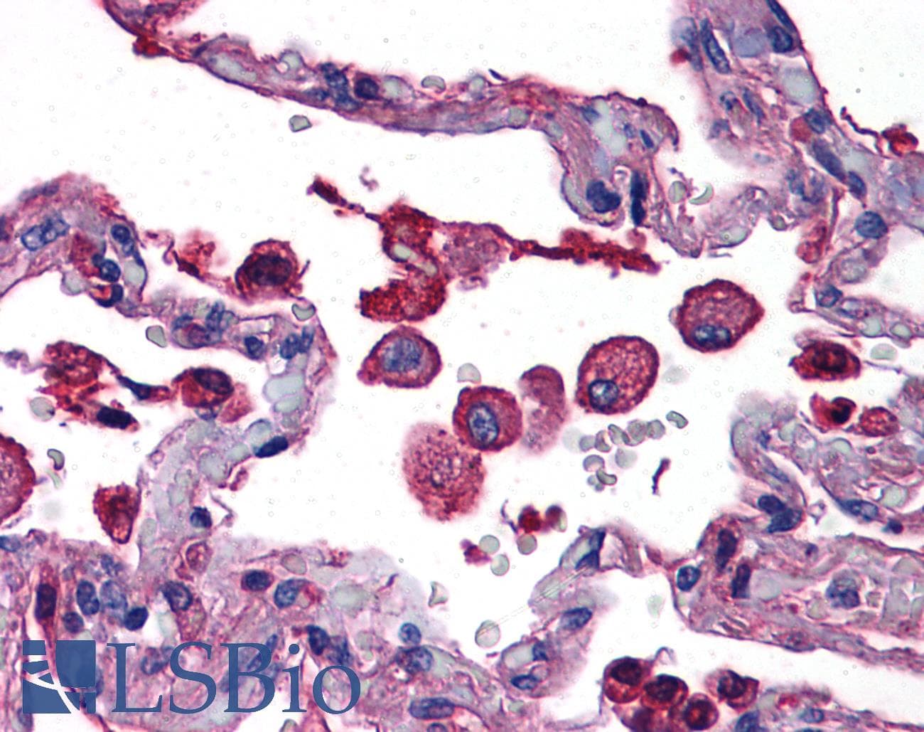 IHC-plus™ TLR7 / CD287 Antibody (aa465-483)
