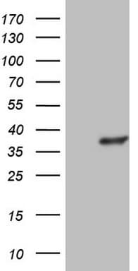 GEMIN8 Antibody (clone OTI5C8)