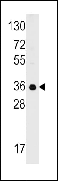 Polyclonal Rabbit anti-Human GC1qR / C1QBP Antibody (aa221-249, WB)