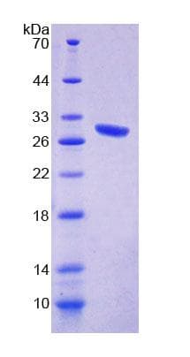 Mouse CHRNE Protein (Recombinant His-T7, N-terminus)