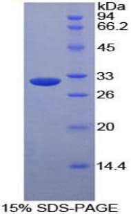 Human CD36 Protein (Recombinant His-T7)