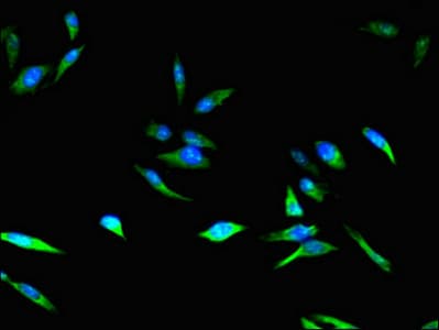 Polyclonal Rabbit anti-Human CDKN2B / p15 INK4b Antibody