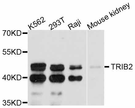 TRIB2 Antibody