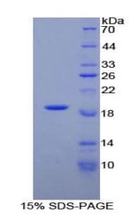 Human PLAA Protein (Recombinant His)