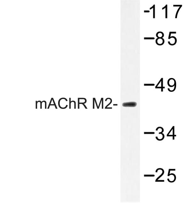 Polyclonal Rabbit anti-Human CHRM2 / M2 Antibody (Pro224, IF, WB)