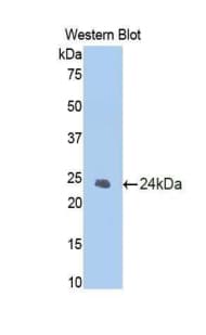 CASP1 / Caspase 1 Antibody (aa119-296)
