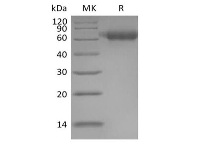 Human IL1RAP Protein (Recombinant 6His, C-terminus)