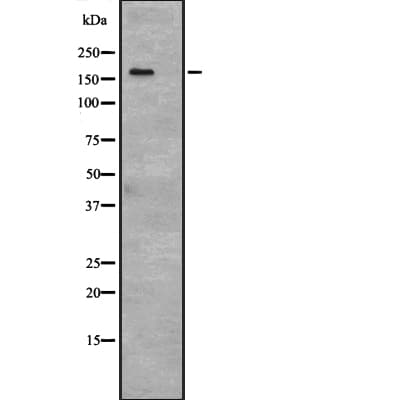 TP53BP2 / ASPP2 Antibody