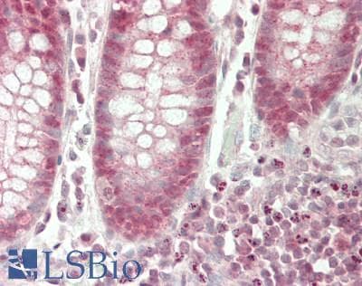 IHC-plus™ Polyclonal Rabbit anti-Human MAF1 Antibody (Internal, IHC, WB)