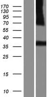 CD1E Protein (Over-Expression Lysate Myc-DDK (Flag))