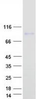 Human CCDC62 Protein (Recombinant Myc-DDK (Flag))