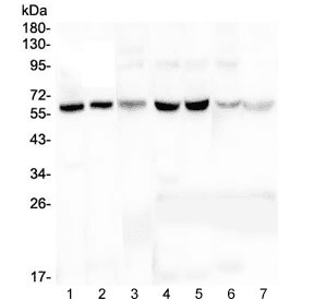 PLAT / TPA Antibody