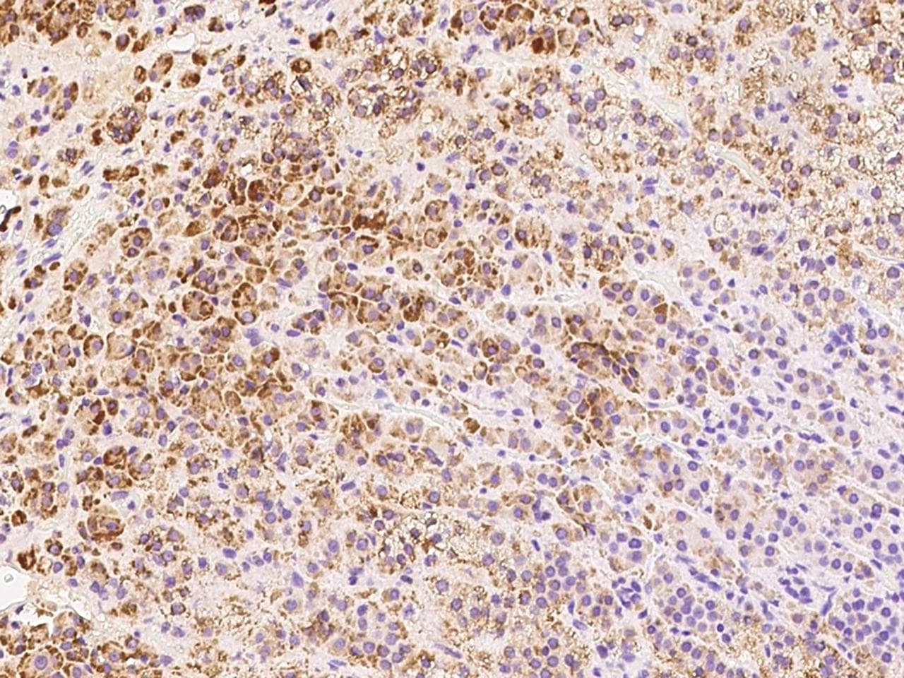AS3MT Antibody