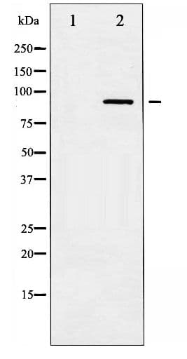 Polyclonal Rabbit anti-Human IKBKB / IKK2 / IKK Beta Antibody (phospho-Tyr199, IHC, WB)