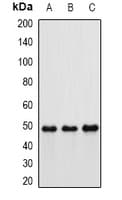 IFT57 / HIPPI Antibody