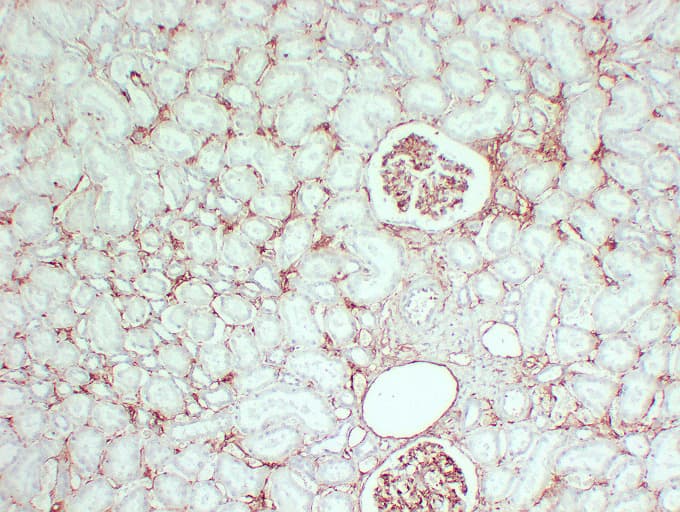 Monoclonal Mouse anti-Human CD105 Antibody (clone ABT-CD105, IHC)