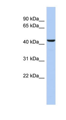 DFFB Antibody (C-Terminus)
