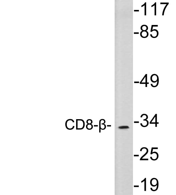 CD8B / CD8 Beta Antibody (aa107-156)