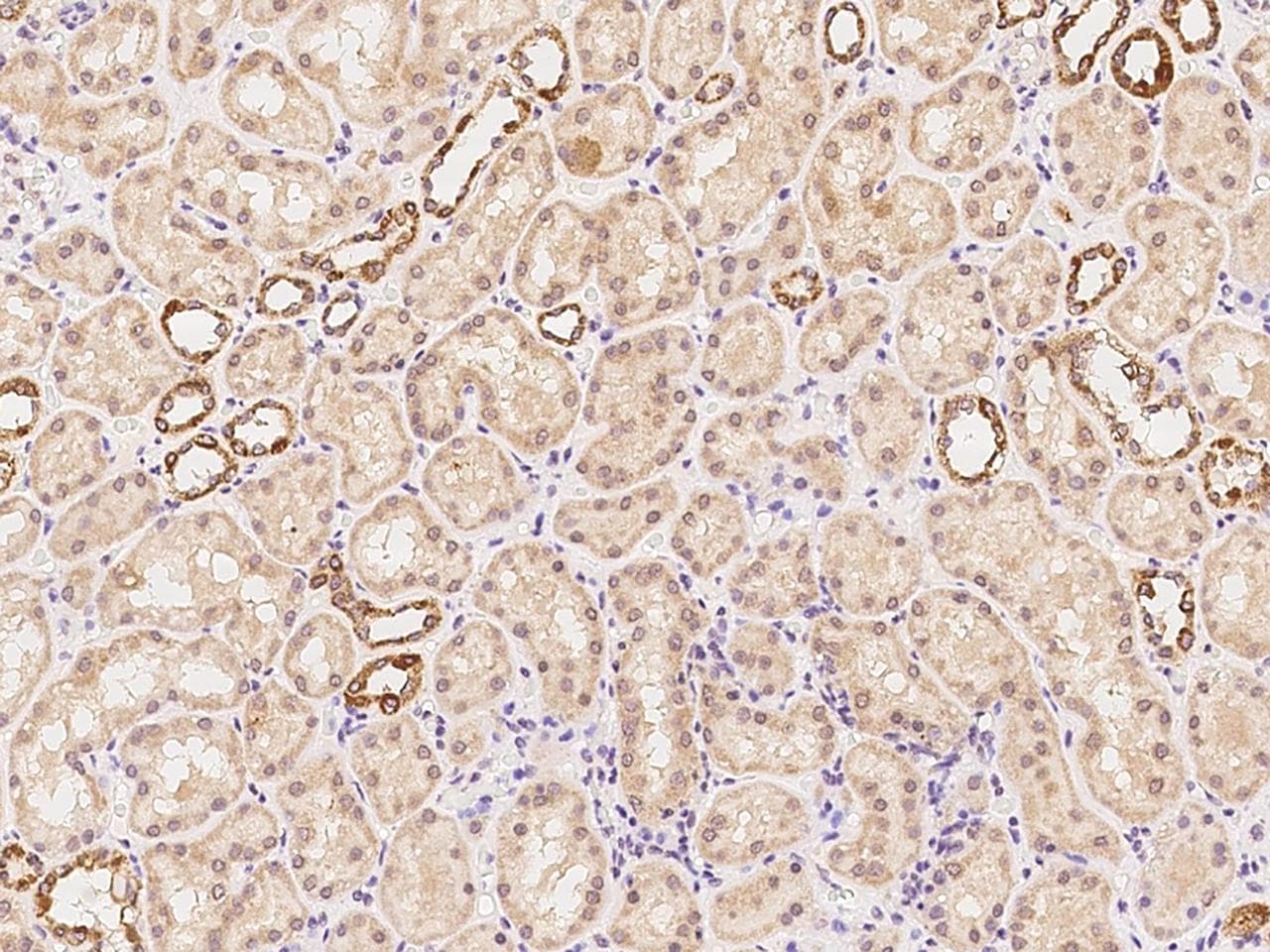PSMD1 Antibody