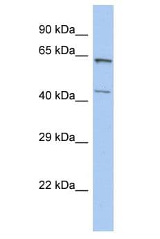 ZCCHC3 Antibody (aa49-98)