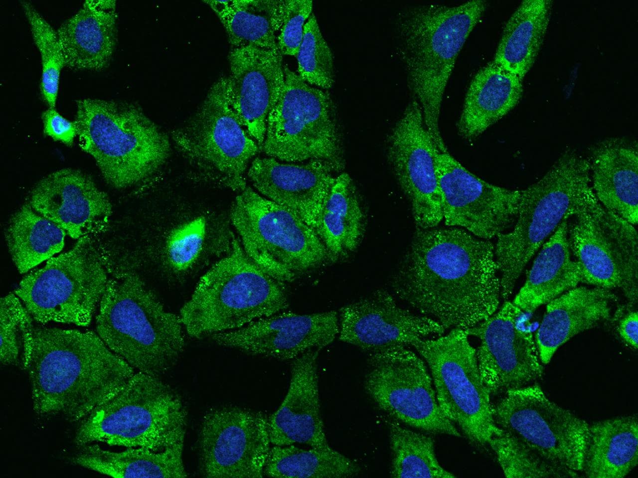 Polyclonal Rabbit anti-Human PABPC4 Antibody (IHC, IF, WB)