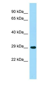 Polyclonal Rabbit anti-Human ACER2 Antibody (aa93-142, WB)