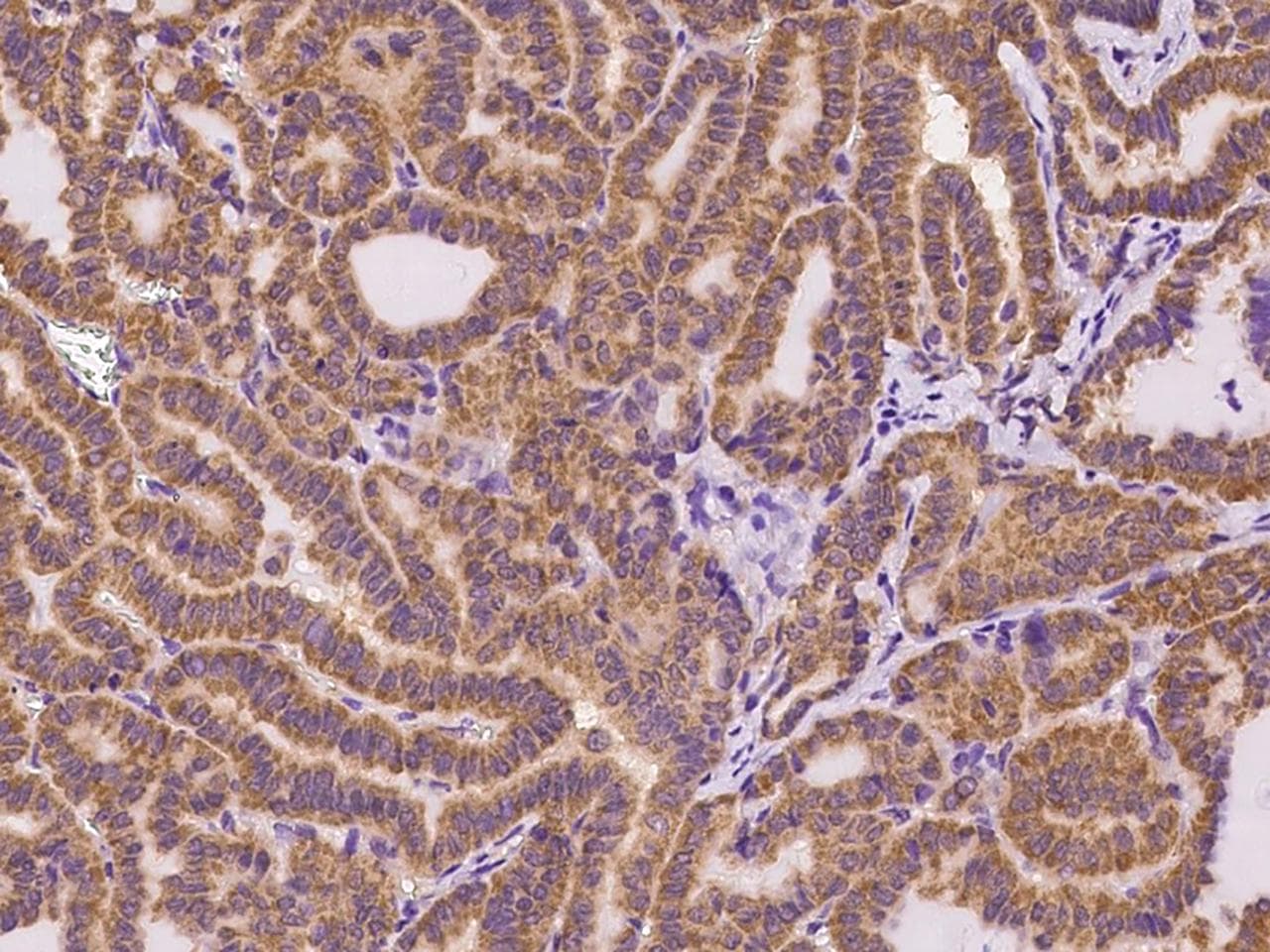 ASL / Argininosuccinate Lyase Antibody