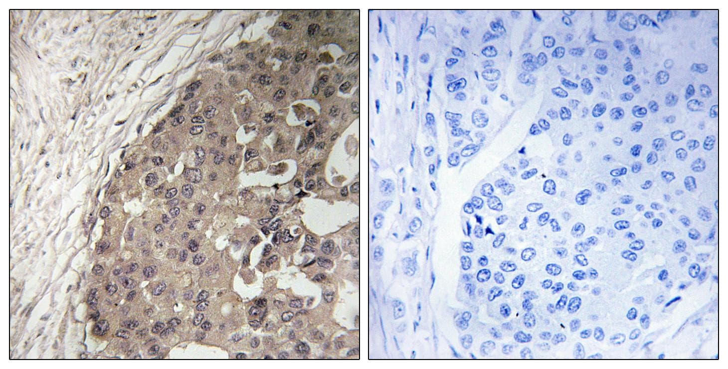 Polyclonal Rabbit anti-Human CSGALNACT1 Antibody (IHC)