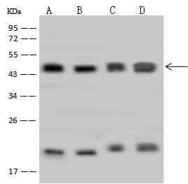 HMBS / PBGD Antibody