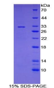Mouse CYP7A1 Protein (Recombinant His-T7)