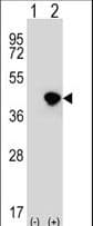 Polyclonal Rabbit anti-Human DFFA / ICAD / DFF45 Antibody (aa304-331, WB)