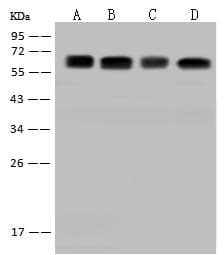 Polyclonal Rabbit anti-Human CDKAL1 Antibody (WB)