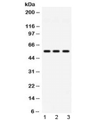 Polyclonal Rabbit anti-Human PIAS4 / PIASY Antibody (WB)