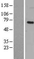 Human DYRK1B Protein (Over-Expression Lysate Myc-DDK (Flag))