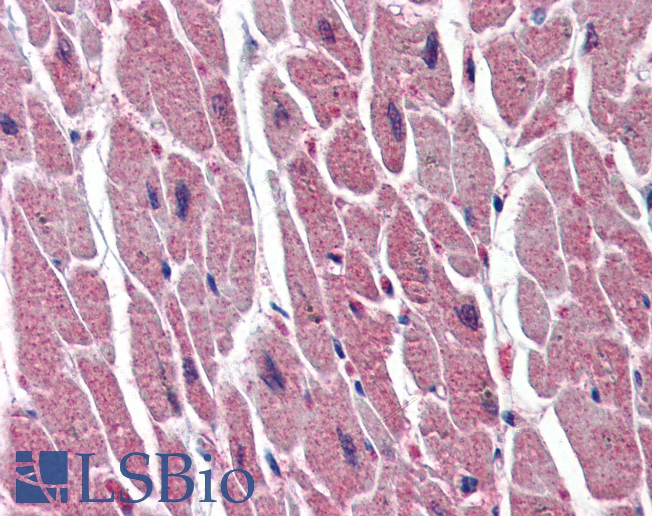 IHC-plus™ Monoclonal Mouse anti-Human UNG / Uracil DNA Glycosylase Antibody (clone K1C12, aa1-313, IHC, WB)