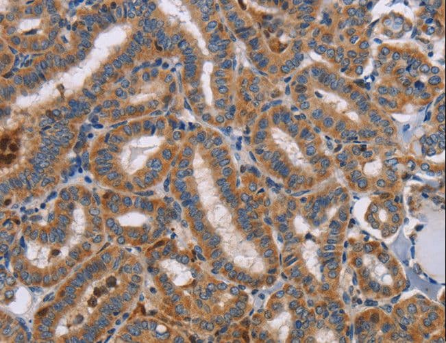 Polyclonal Rabbit anti-Human TLR8 Antibody (IHC)