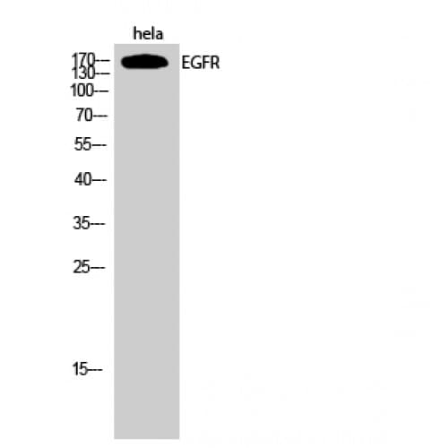 EGFR Antibody (960-1040 aa)