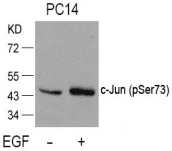 Polyclonal Rabbit anti-Human JUN / c-Jun Antibody (IHC, WB)